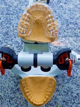 Imagen que contiene par, pequeño, nieve, moto  Descripción generada automáticamente